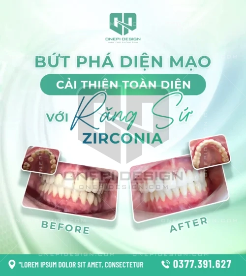 Tải Mẫu PSD Quảng Cáo Răng Sứ Zirconia Bố Cục Trước & Sau Chuyên Nghiệp
